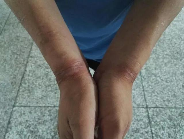 善待每一条生命，让精神病患者活得更有尊严!(图2)